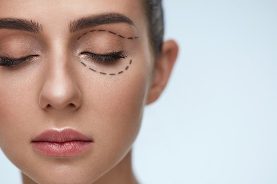Emotional Boost from Eyelid Surgery in Riyadh: Beyond Physical Changes